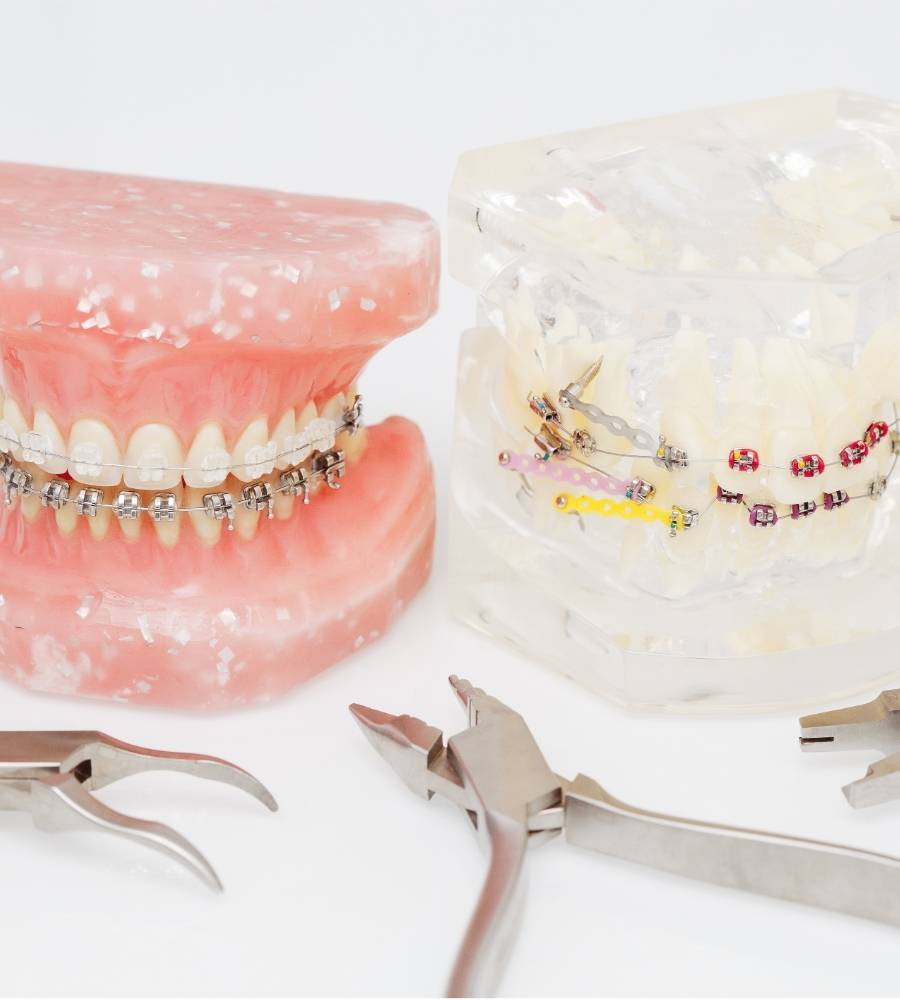 orthodontics appliances