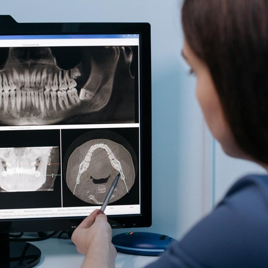 orthodontist checking dental results