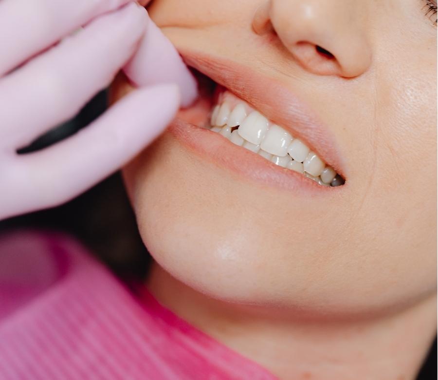 woman for an orthodontic consultation