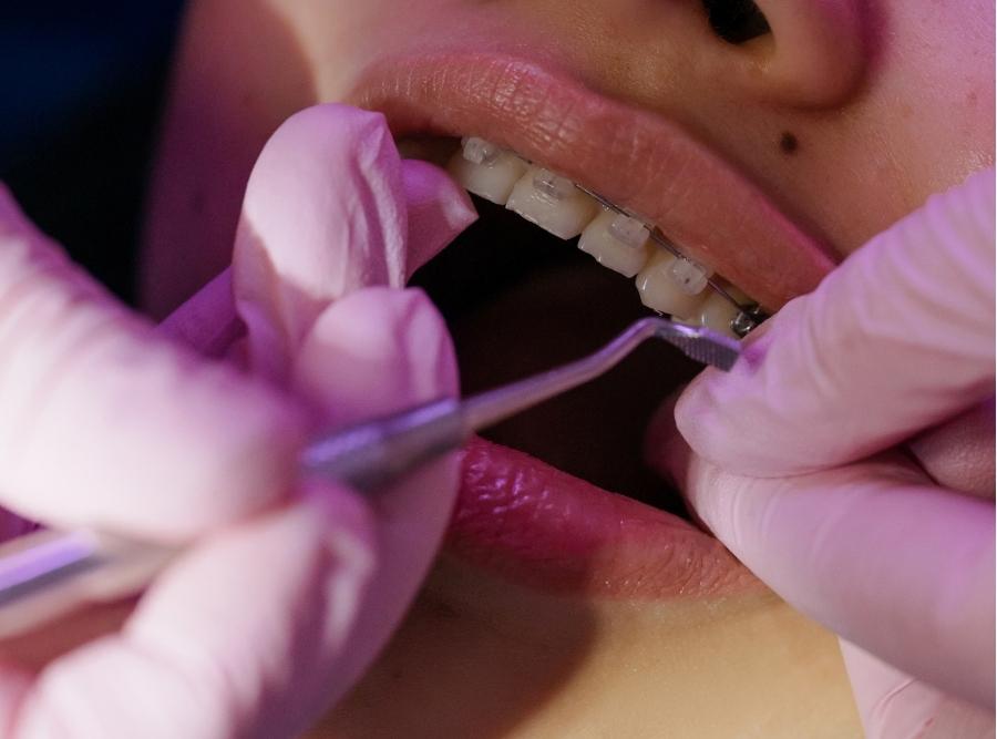 orthodontist checking patient's braces