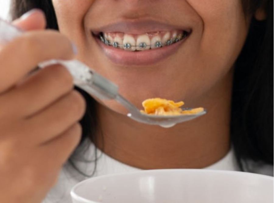 Close-up of a teenage girl smiling with metal braces while eating cereal from a bowl, showing braces-friendly breakfast food during orthodontic treatment.