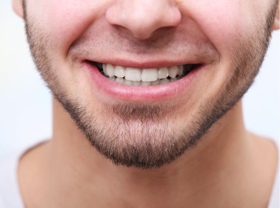 Close-up of a man’s lower face and jaw showing proper teeth alignment and correct bite position after orthodontic treatment.