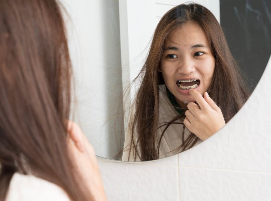 Woman with long hair looking at her reflection in the bathroom mirror, checking her dental braces and smile appearance.