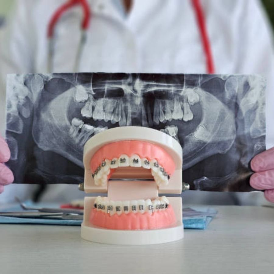 A dental professional holding a panoramic X-ray behind a teeth model with braces, demonstrating orthodontic care in Burnettown, SC.
