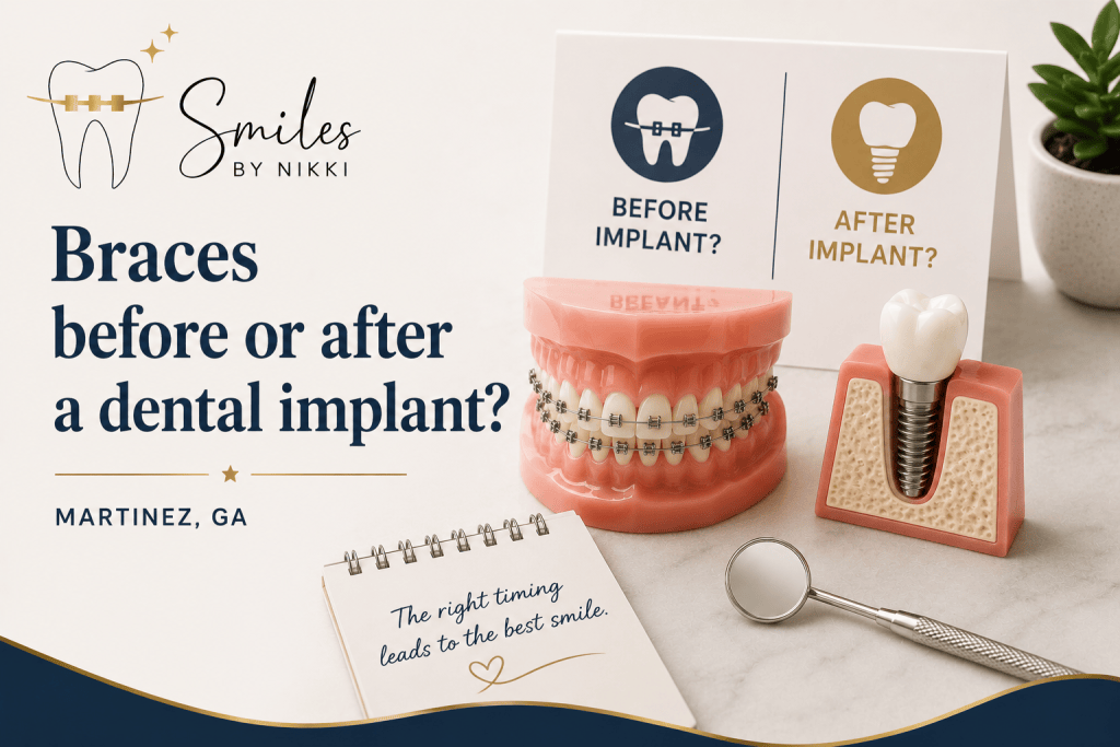 Braces Before or After a Dental Implant in Martinez?
